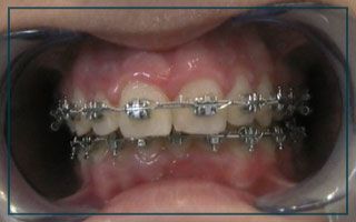 Clínica Dental Óscar Neme ortodoncia
